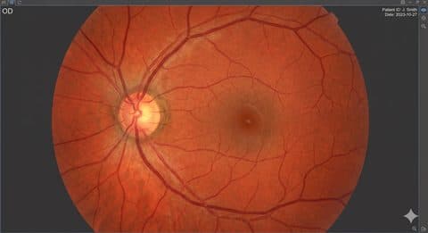 Understanding Your Eye Test Results & Prescription